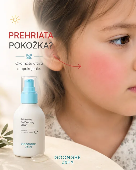 Photo by Goongbe Slovensko on July 17, 2026. Na obrázku môže byť tužidlo na vlasy, mlieko, lekárska masť a text, v ktorom sa píše „PREHRIATA POKOŽKA? Okamžitá άί'ανα a upokojenie. 